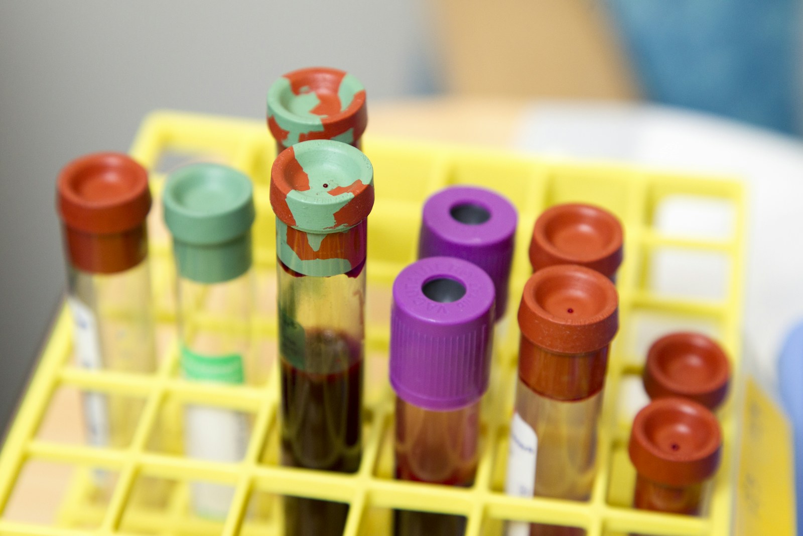 Muestras en tubos dentro de un laboratorio
